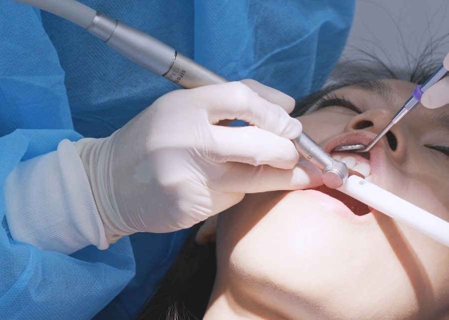 Implantologia dentale Milano: a chi rivolgersi